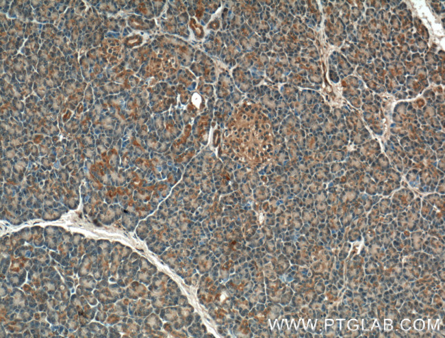 GTPBP2 Antibody in Immunohistochemistry (Paraffin) (IHC (P))