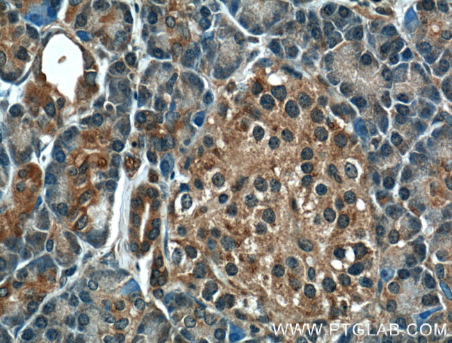 GTPBP2 Antibody in Immunohistochemistry (Paraffin) (IHC (P))