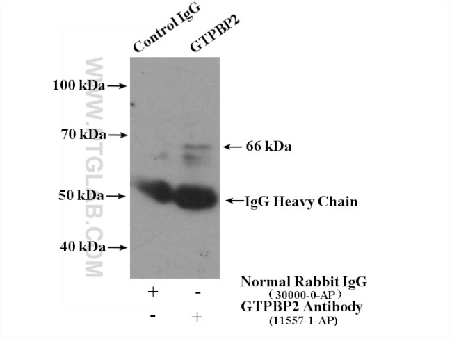 GTPBP2 Antibody in Immunoprecipitation (IP)