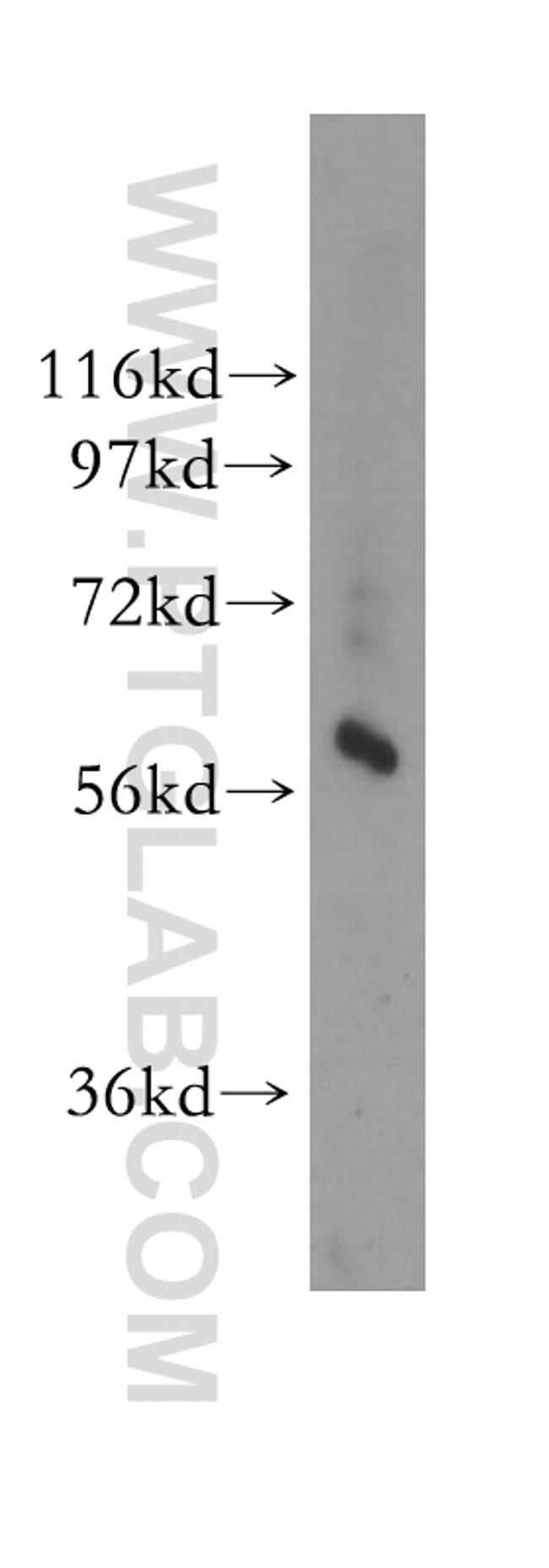 GTPBP2 Antibody in Western Blot (WB)