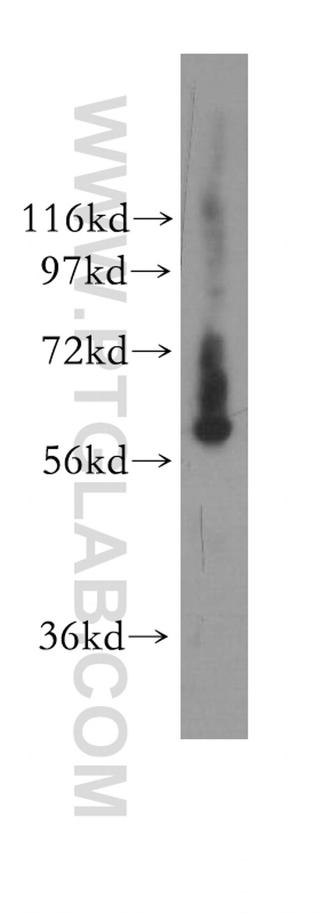 GTPBP2 Antibody in Western Blot (WB)