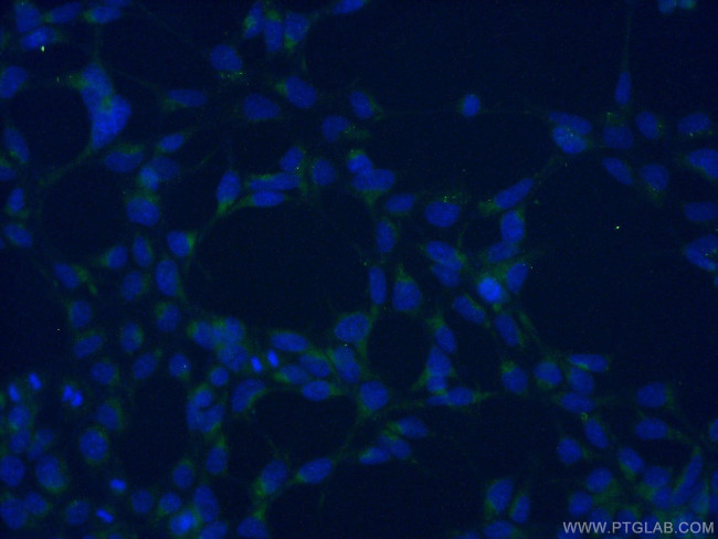 AGTRAP Antibody in Immunocytochemistry (ICC/IF)