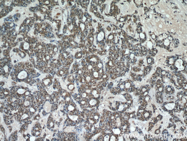 ING2 Antibody in Immunohistochemistry (Paraffin) (IHC (P))