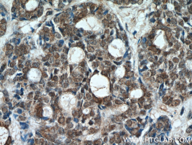 ING2 Antibody in Immunohistochemistry (Paraffin) (IHC (P))