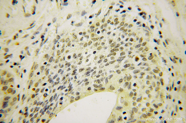 ING2 Antibody in Immunohistochemistry (Paraffin) (IHC (P))