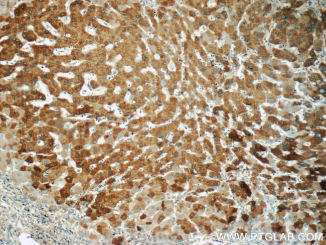 DGAT1 Antibody in Immunohistochemistry (Paraffin) (IHC (P))