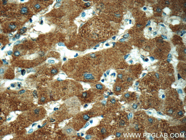 DGAT1 Antibody in Immunohistochemistry (Paraffin) (IHC (P))