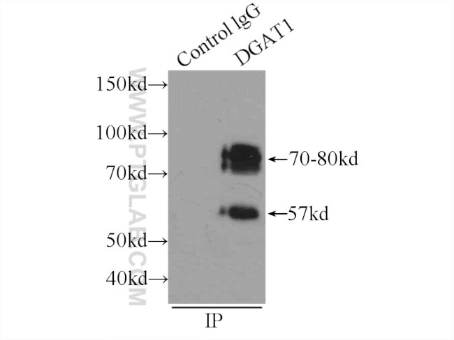 DGAT1 Antibody in Immunoprecipitation (IP)
