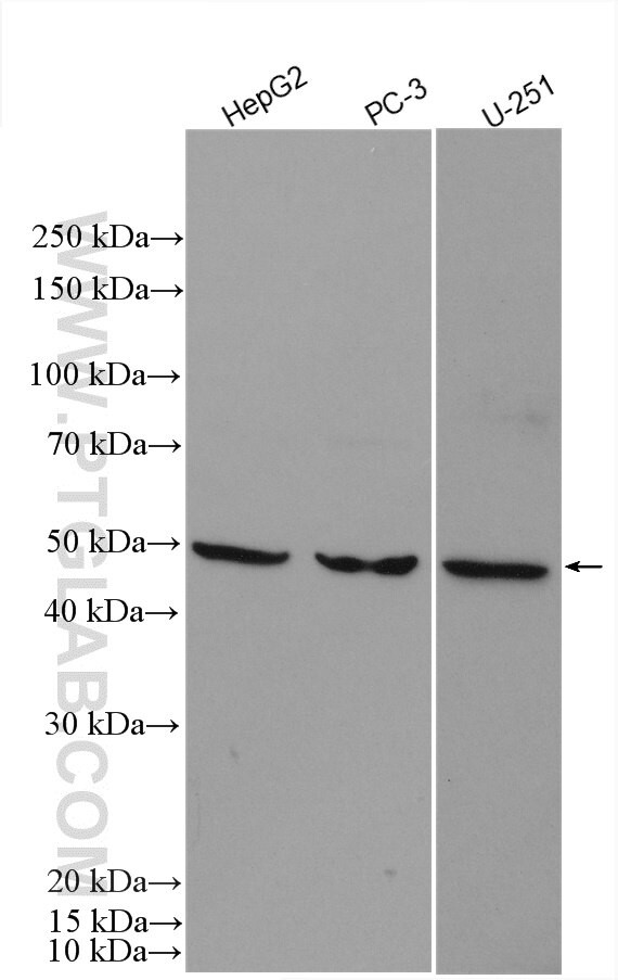 DGAT1 Antibody in Western Blot (WB)