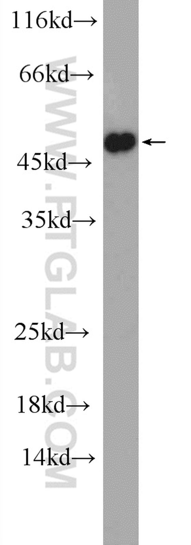 DGAT1 Antibody in Western Blot (WB)