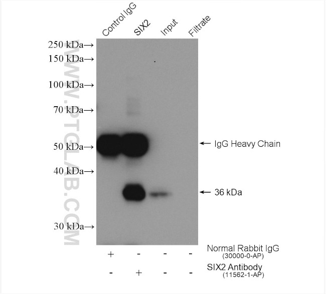 SIX2 Antibody in Immunoprecipitation (IP)