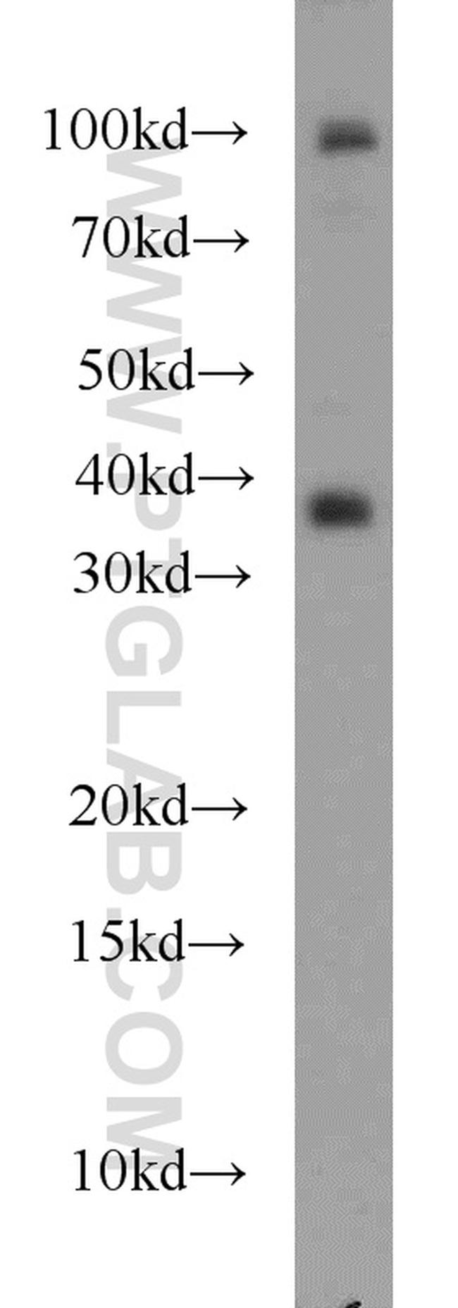 SIX2 Antibody in Western Blot (WB)