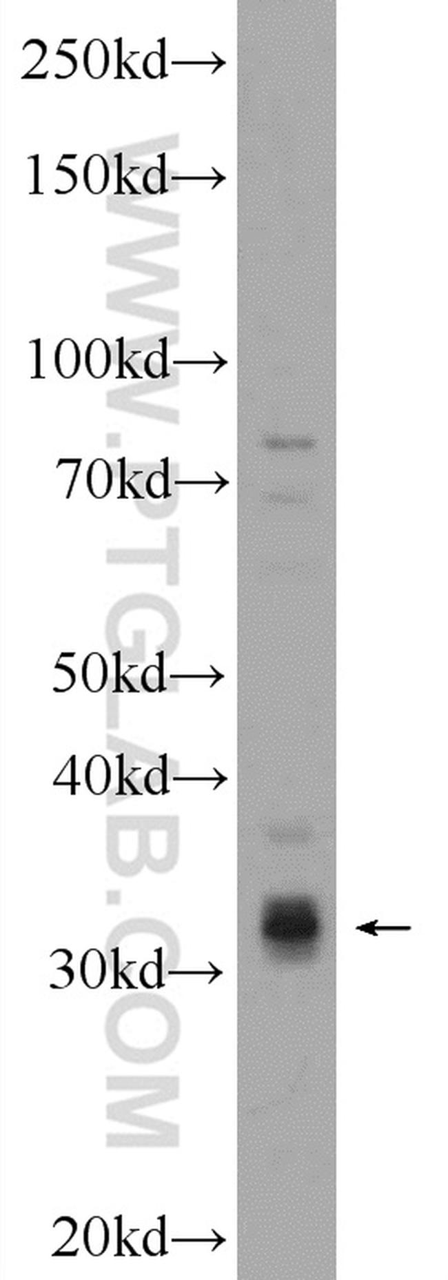 SIX2 Antibody in Western Blot (WB)