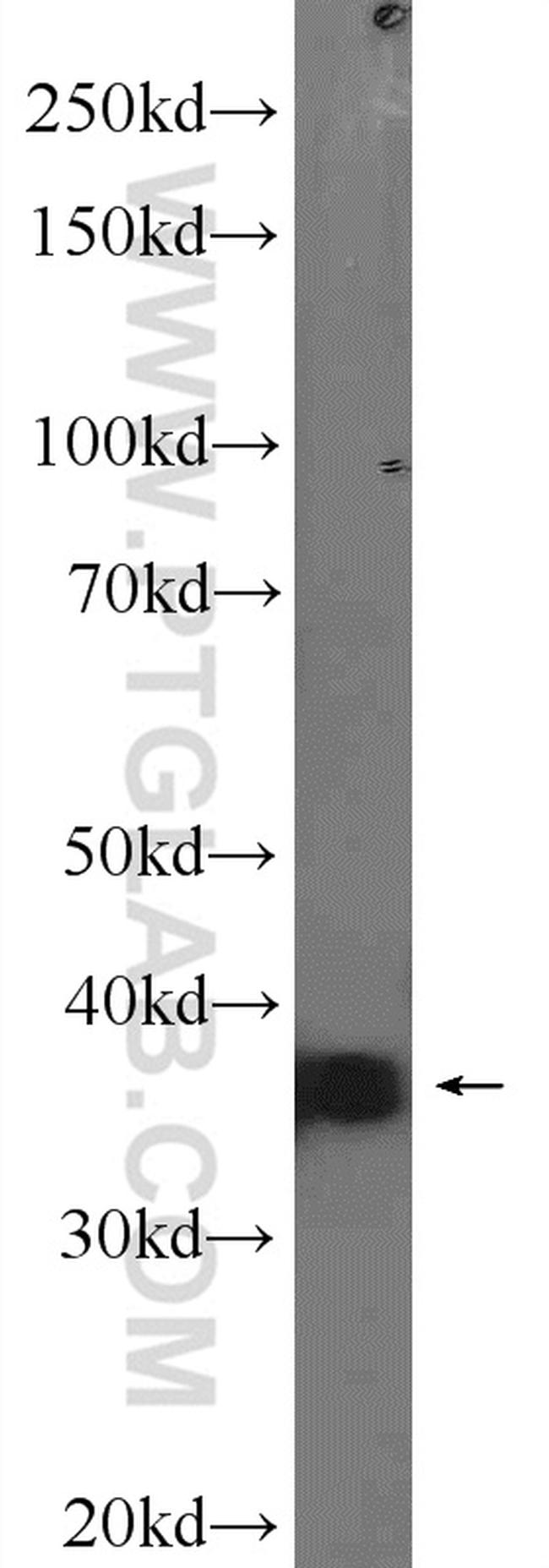 SIX2 Antibody in Western Blot (WB)