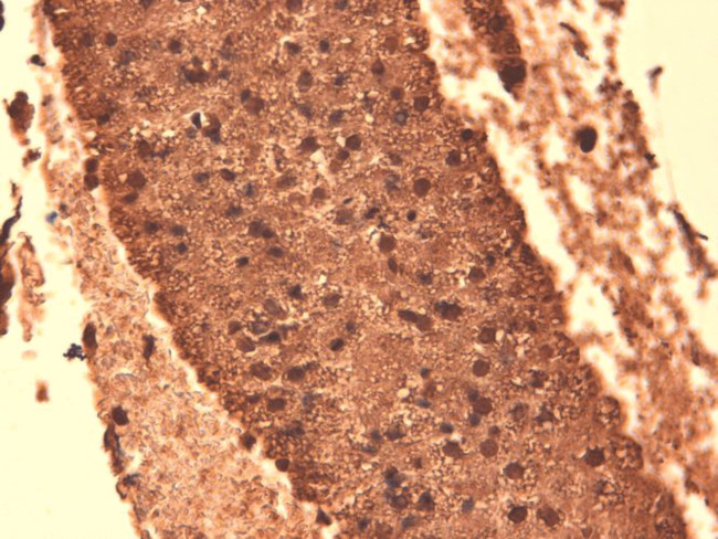 Sodium Iodine Symporter Antibody in Immunohistochemistry (PFA fixed) (IHC (PFA))