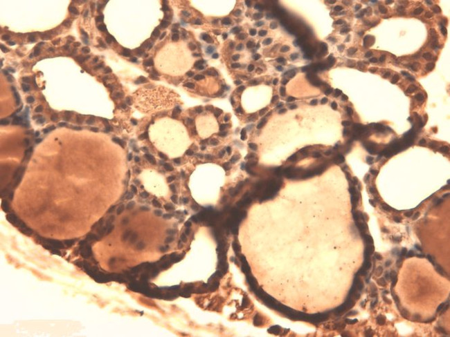 Sodium Iodine Symporter Antibody in Immunohistochemistry (PFA fixed) (IHC (PFA))