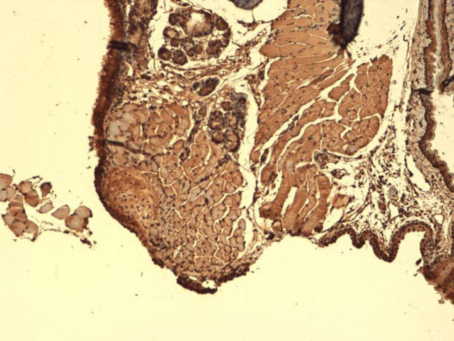 Sodium Iodine Symporter Antibody in Immunohistochemistry (PFA fixed) (IHC (PFA))