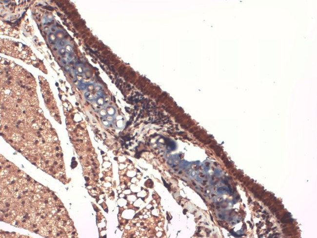 Sodium Iodine Symporter Antibody in Immunohistochemistry (PFA fixed) (IHC (PFA))