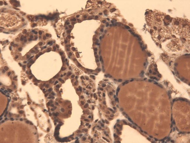 Sodium Iodine Symporter Antibody in Immunohistochemistry (PFA fixed) (IHC (PFA))