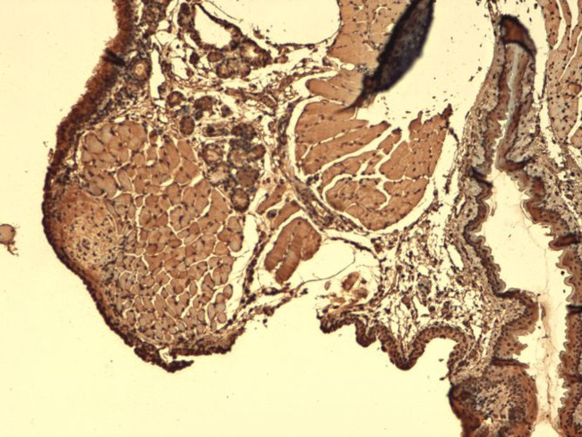 Sodium Iodine Symporter Antibody in Immunohistochemistry (PFA fixed) (IHC (PFA))