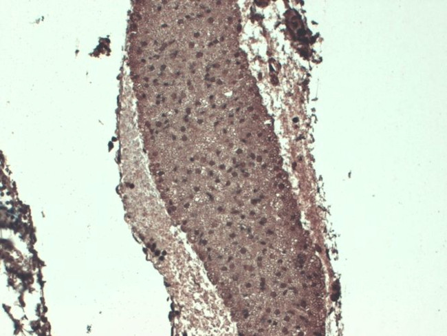 Sodium Iodine Symporter Antibody in Immunohistochemistry (PFA fixed) (IHC (PFA))