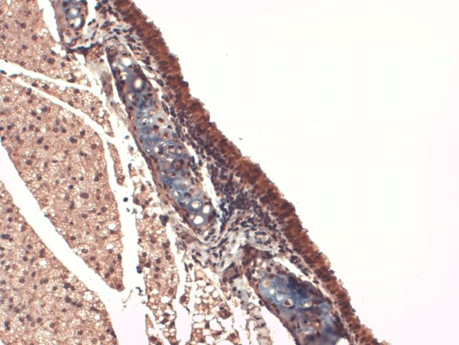 Sodium Iodine Symporter Antibody in Immunohistochemistry (PFA fixed) (IHC (PFA))