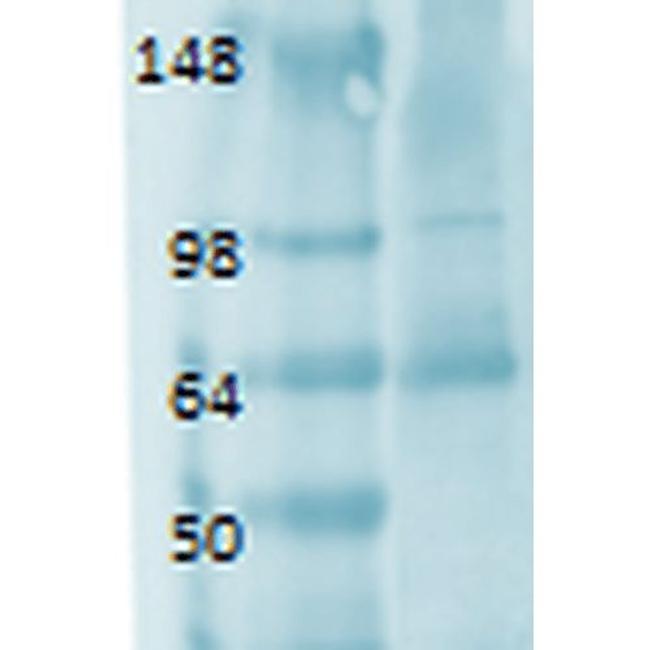 Sodium Iodine Symporter Antibody in Western Blot (WB)