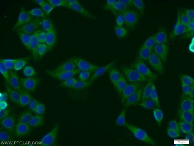 BMSC UbP Antibody in Immunocytochemistry (ICC/IF)