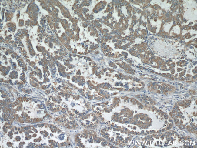 STIM1 Antibody in Immunohistochemistry (Paraffin) (IHC (P))