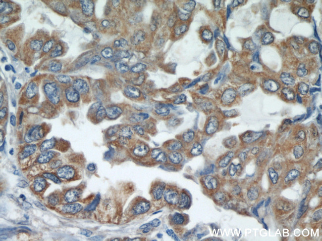 STIM1 Antibody in Immunohistochemistry (Paraffin) (IHC (P))