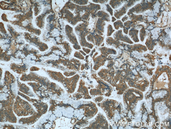 STIM1 Antibody in Immunohistochemistry (Paraffin) (IHC (P))