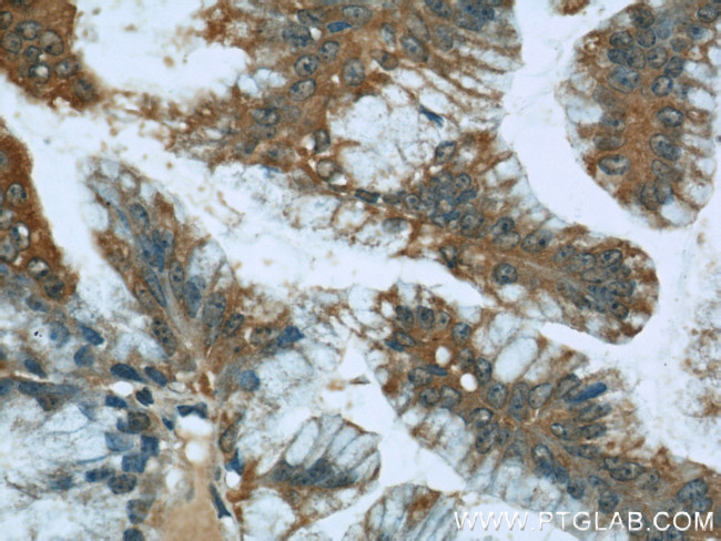 STIM1 Antibody in Immunohistochemistry (Paraffin) (IHC (P))