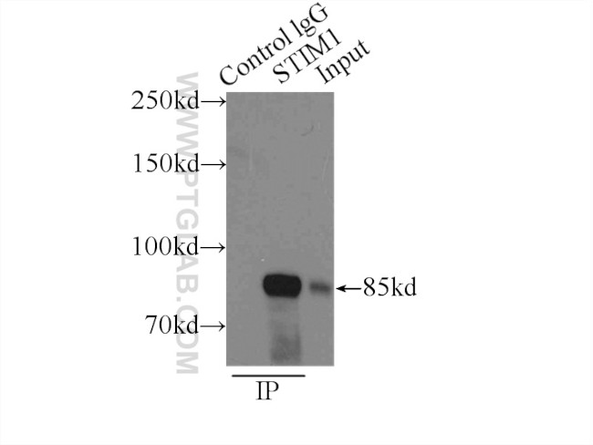 STIM1 Antibody in Immunoprecipitation (IP)