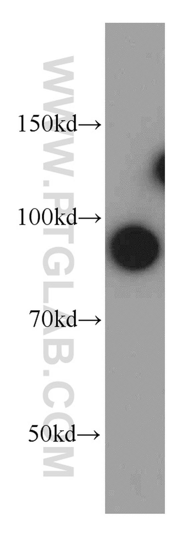 STIM1 Antibody in Western Blot (WB)