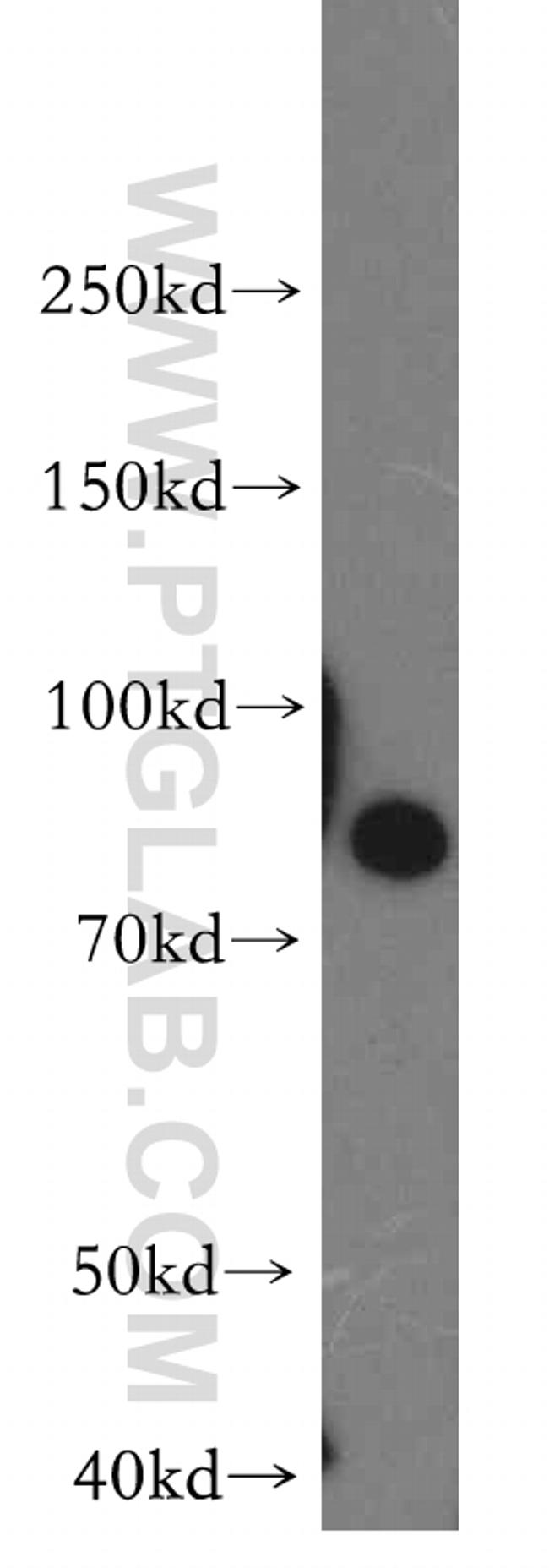 STIM1 Antibody in Western Blot (WB)