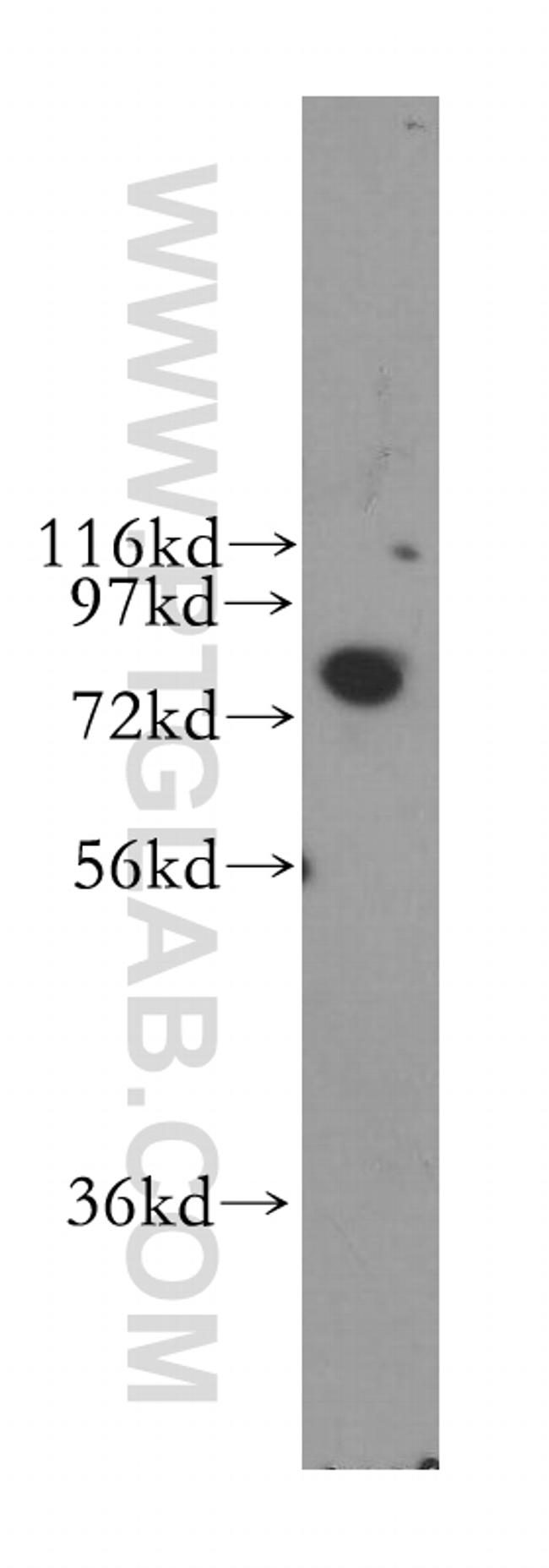 STIM1 Antibody in Western Blot (WB)