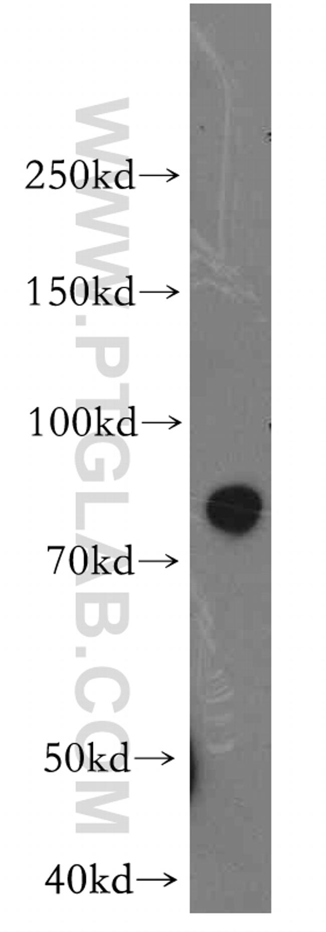 STIM1 Antibody in Western Blot (WB)