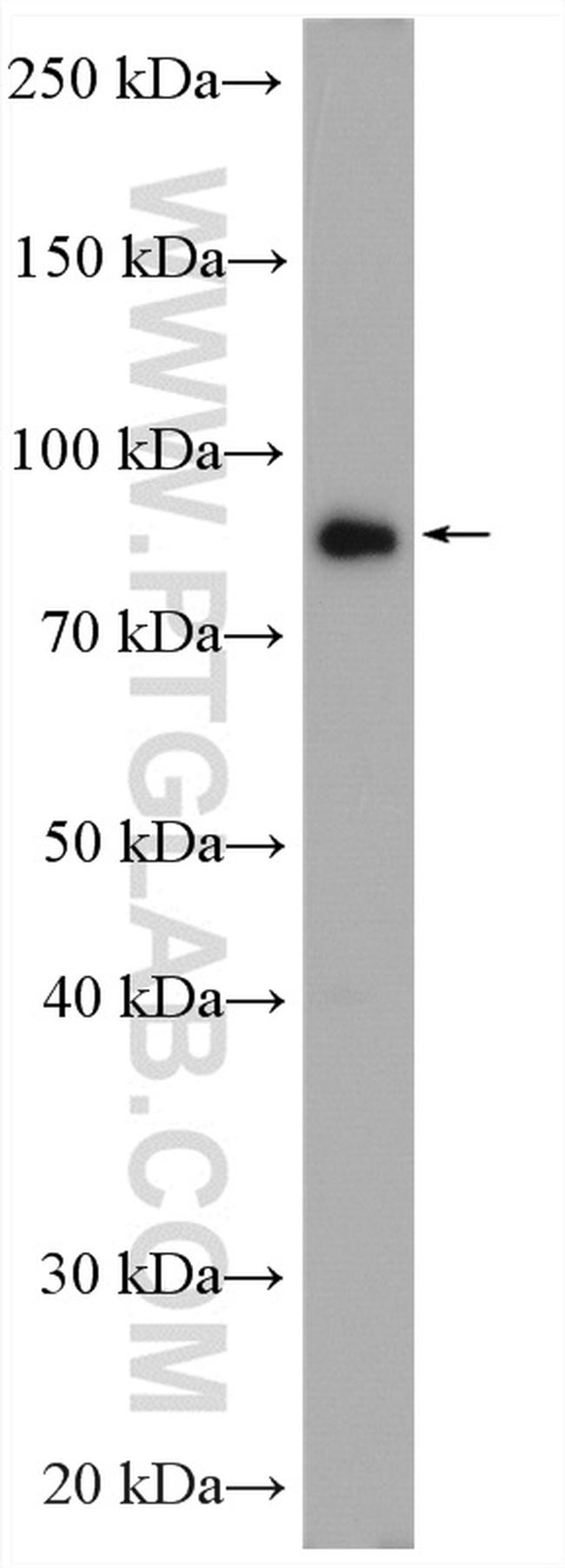 STIM1 Antibody in Western Blot (WB)