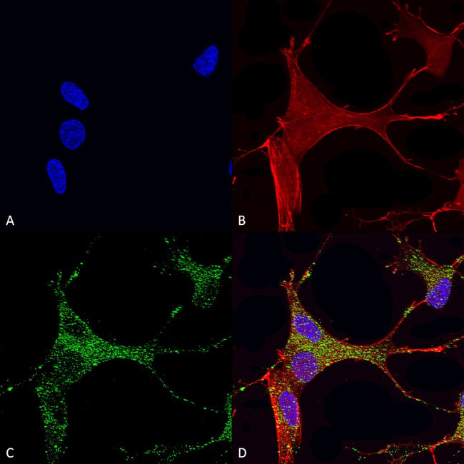 Cav3.1 Ca+2 Channel Antibody in Immunocytochemistry (ICC/IF)