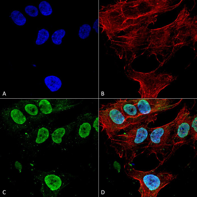 Cav3.1 Ca+2 Channel Antibody in Immunocytochemistry (ICC/IF)