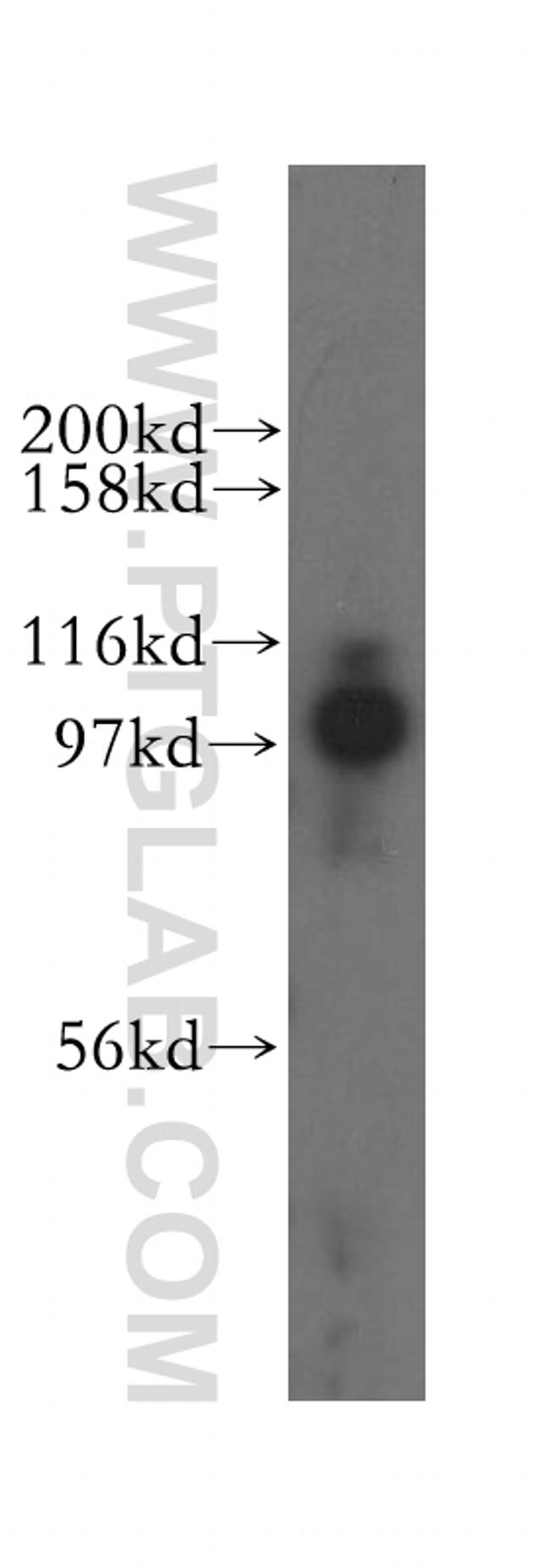 MED15 Antibody in Western Blot (WB)