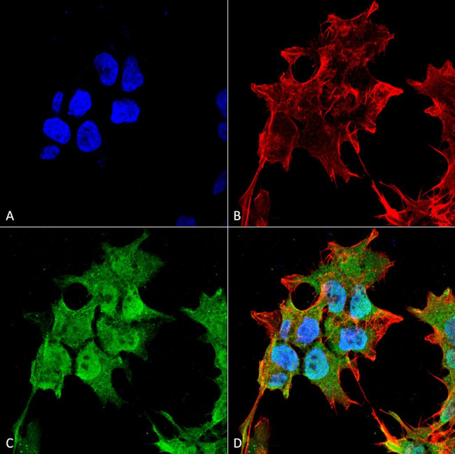 SUR1 Antibody in Immunocytochemistry (ICC/IF)