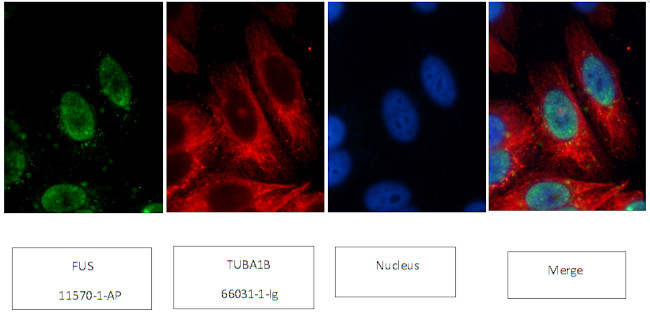 FUS/TLS Antibody in Immunocytochemistry (ICC/IF)