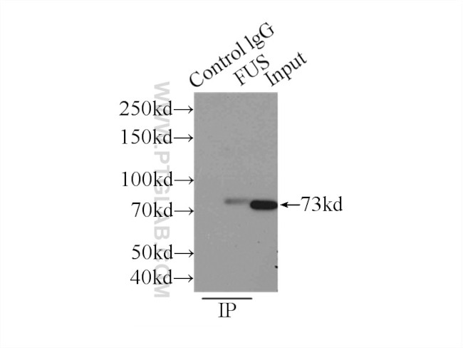 FUS/TLS Antibody in Immunoprecipitation (IP)