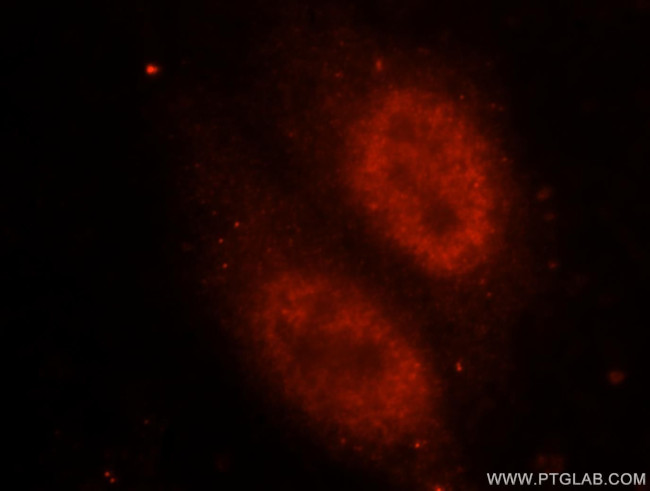 FUS/TLS Antibody in Immunocytochemistry (ICC/IF)