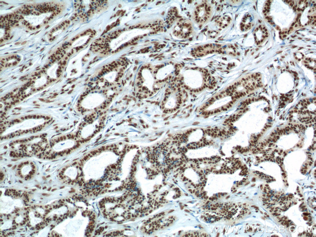 FUS/TLS Antibody in Immunohistochemistry (Paraffin) (IHC (P))