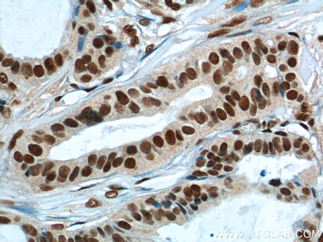 FUS/TLS Antibody in Immunohistochemistry (Paraffin) (IHC (P))