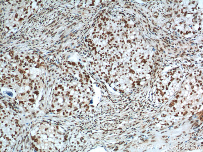 FUS/TLS Antibody in Immunohistochemistry (Paraffin) (IHC (P))