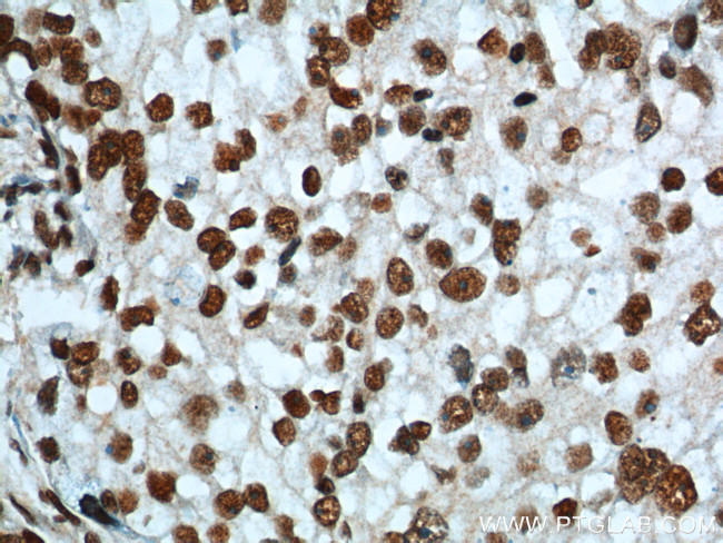 FUS/TLS Antibody in Immunohistochemistry (Paraffin) (IHC (P))