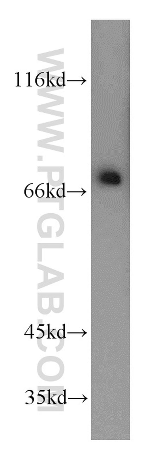 FUS/TLS Antibody in Western Blot (WB)